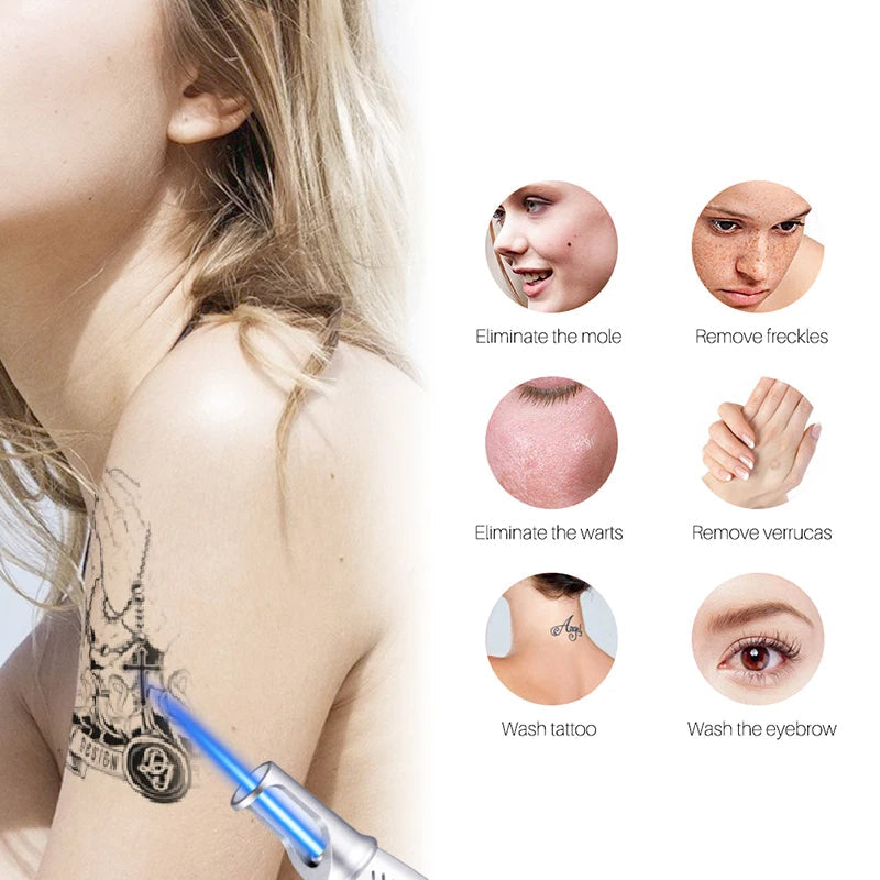 Stylo Laser pour l'Élimination des Tatouages, Moles et Taches de Rousseur