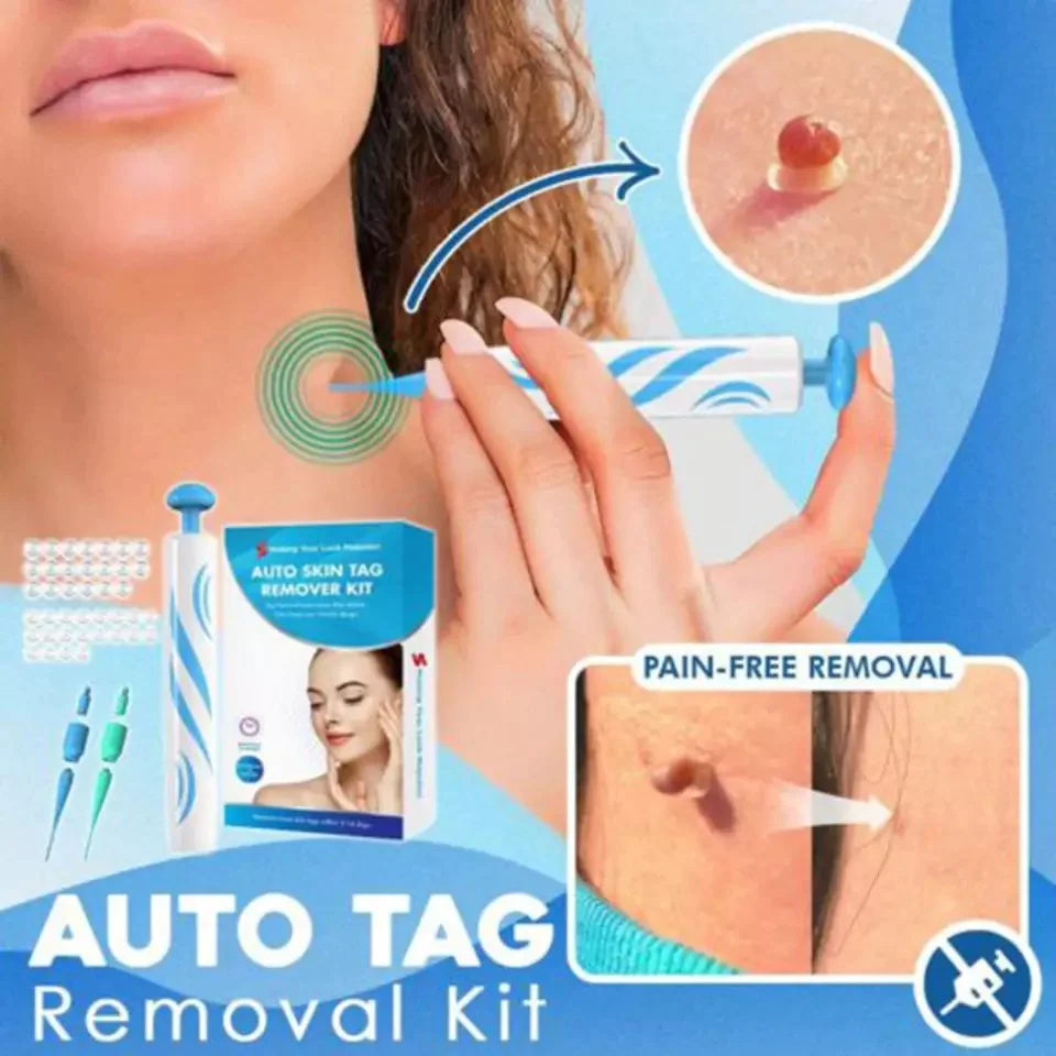 Kit de Retrait de Grains de Beauté - Éliminez les Grains de Beauté sans Effort