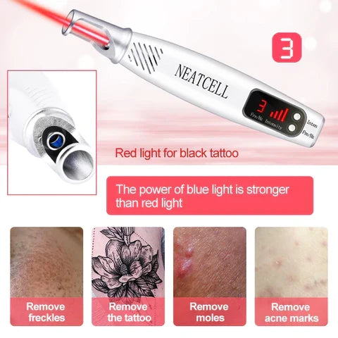 Stylo Laser pour l'Élimination des Tatouages, Moles et Taches de Rousseur